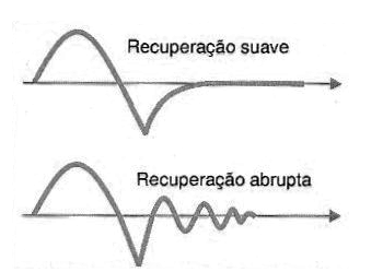 Figura 32 – Modos de recuperação de um diodo
