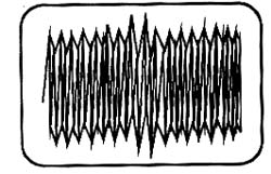 Sinal do separador com forte componente de zumbido de 60 Hz. 