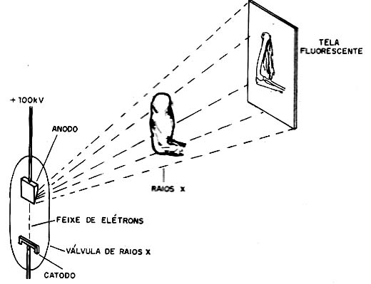 Os raios X são produzidos pelo impacto de elétrons por tensões muito altas. 