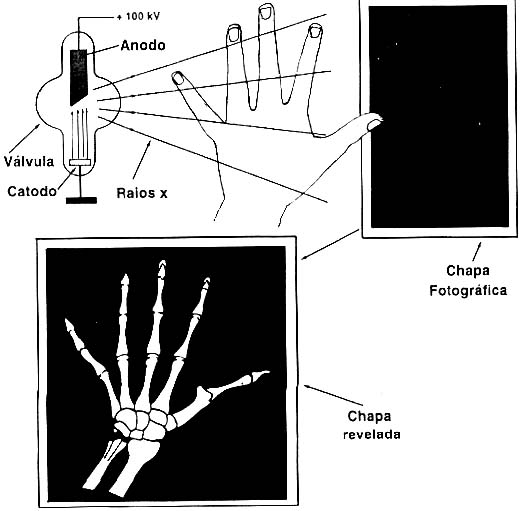 Como funciona a radiografia. 