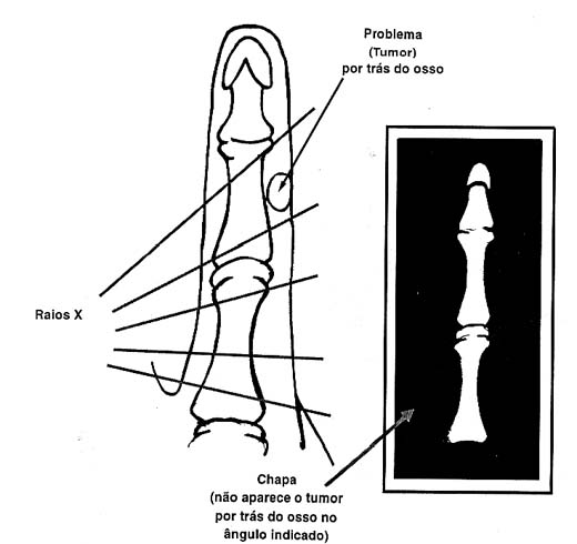 Nem sempre a radiografia detecta problemas. 