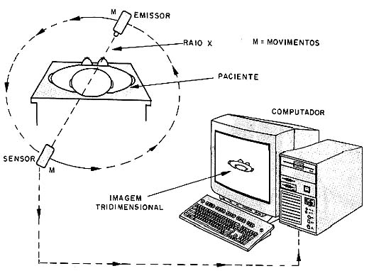 A tomografia computadorizada. 